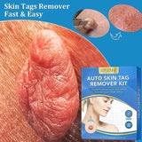 Skin Tag Remover